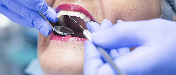 Best Emergency Treatment for Dental Infections or Abscesses in West Haverstraw, NY